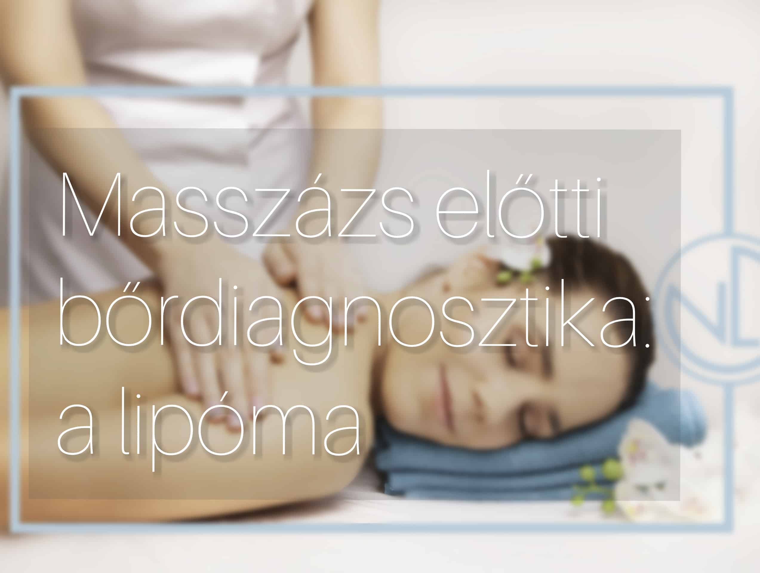 Mit csinálj, ha találsz magadon egy jóindulatú zsírdaganatot.